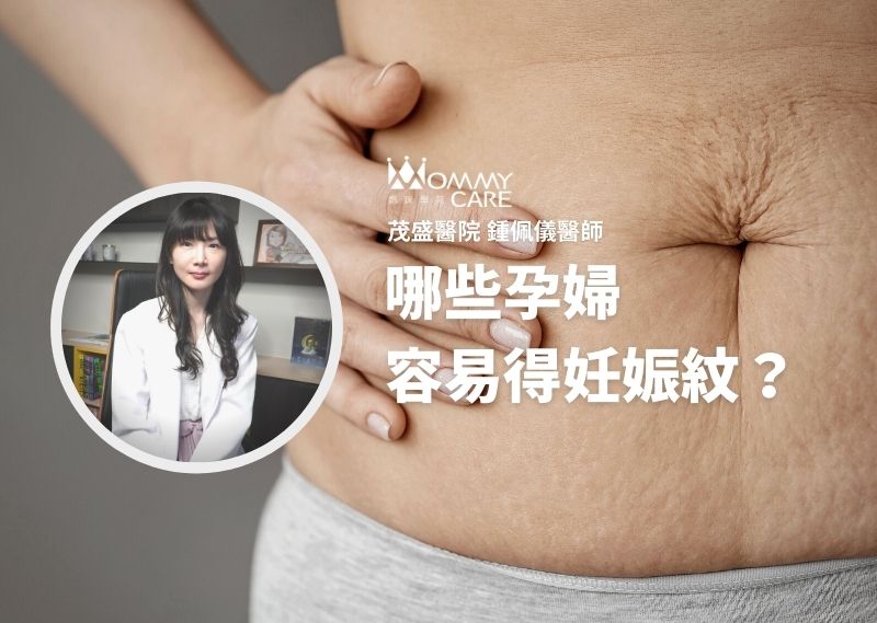 哪些孕婦容易得妊娠紋